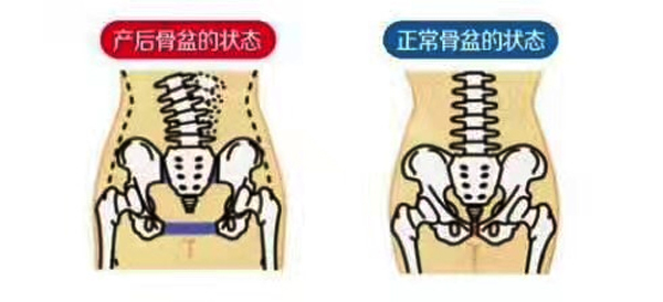 盆腔脏器脱落:脱垂,阴道前后壁膨出 膀胱膨出,直肠脱垂.